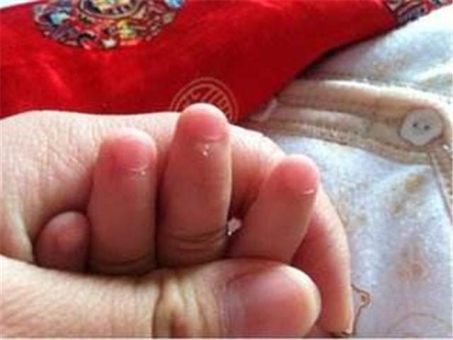 宝宝指甲上有白点是肚子里有蛔虫?长倒刺是缺乏维生素