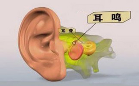 耳鸣的危害主要有哪些呢