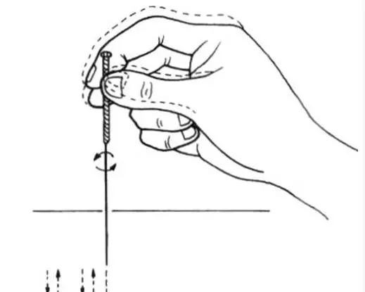 针灸手法:如何在针灸时快速得气?
