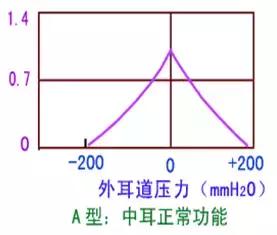 a型曲线表示鼓膜—听骨链活动度正常,声顺值正常,中耳传音结构正常