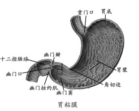 平时需要怎样预防形成幽门梗阻