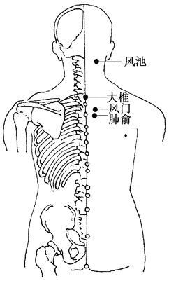 刮痧法的实验原理是什么_中暑刮痧是什么颜色