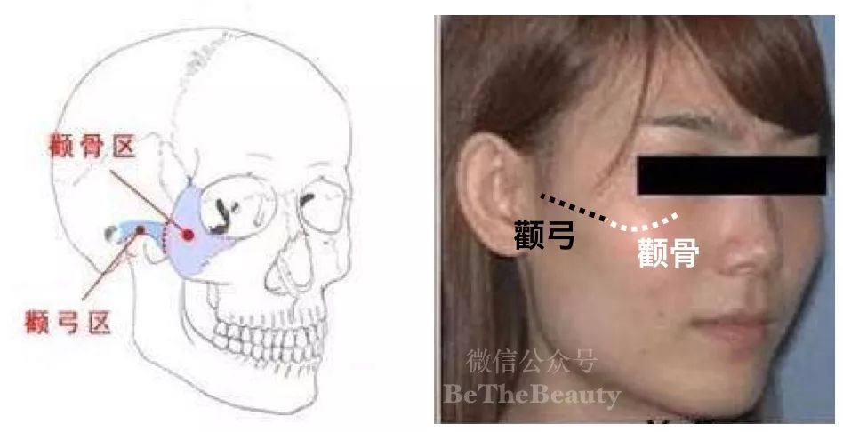 先了解我们讨论的 「颧骨」「颧弓」到底是什么