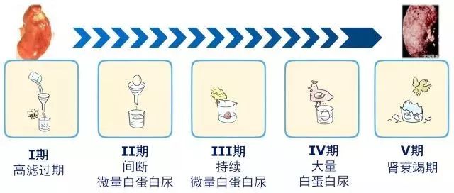 糖尿病肾病分期为i期高滤过期,ii期间断微量白蛋白尿,iii期持续微量