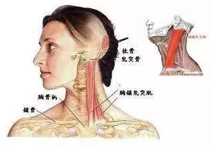 罗氏正骨—胸锁乳突肌损伤的诊断与治疗手法