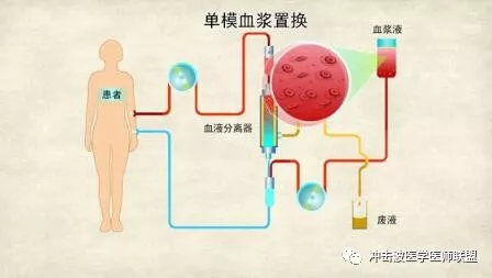 血浆置换或免疫吸附治疗有哪些注意事项?