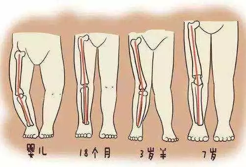 宝宝o型,x型腿,踮脚走路,腿纹不对称?看完这篇文章就不纠结了