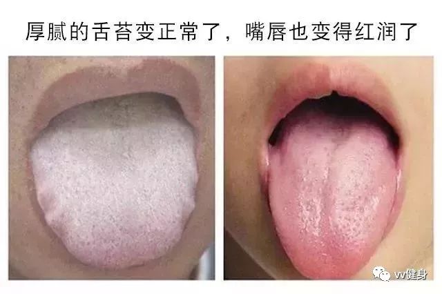 后来在我的推荐下让她老婆使用银仁谷,一个月之后,她的舌苔恢复了正常