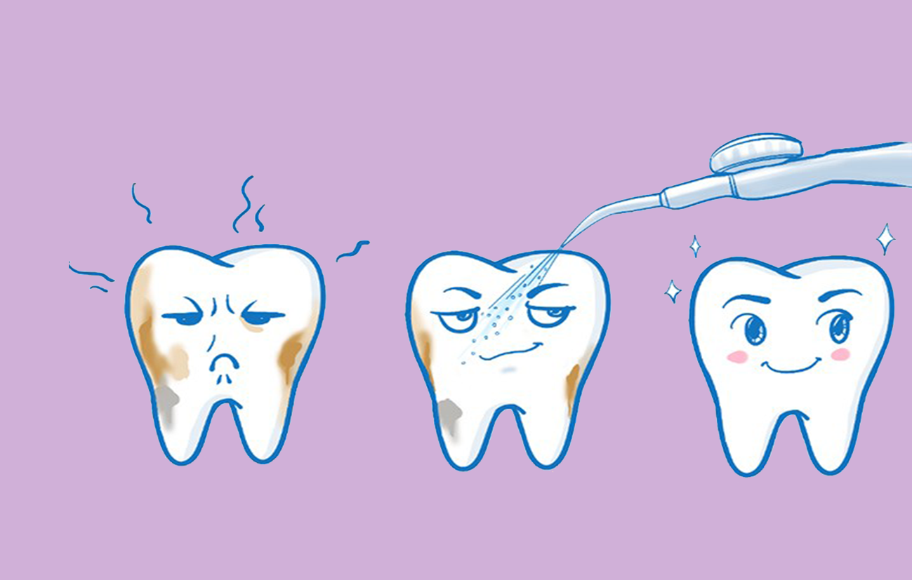 牙龈经常出血,要不要去洗牙?