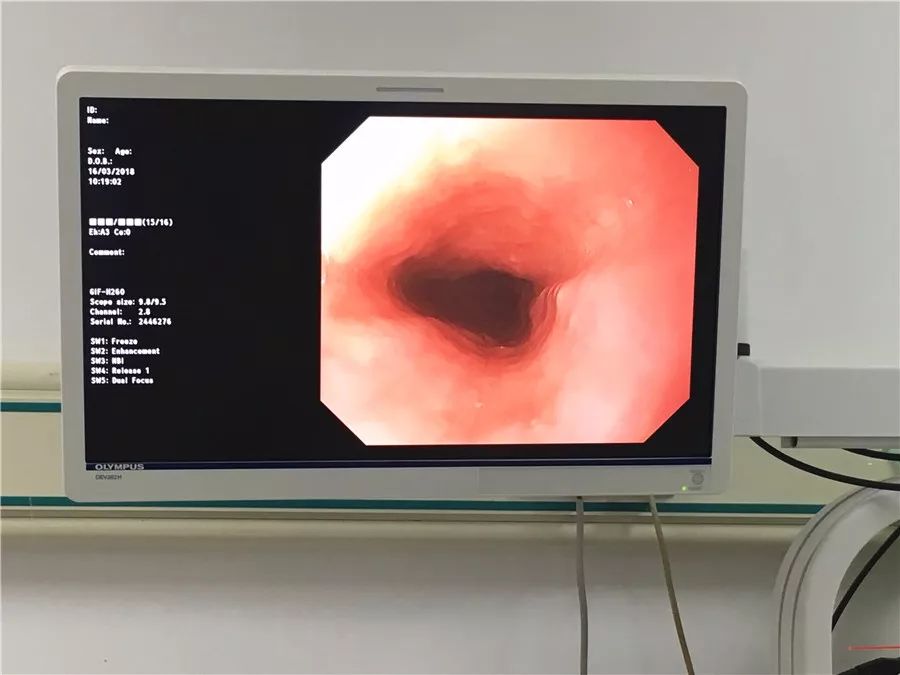 知识胃镜检查其实没你想象中的那么可怕