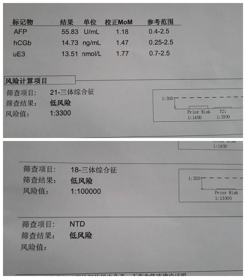 怀孕超过20周还有必要做唐氏筛查吗?