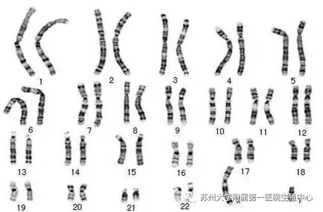 xyy染色体的人的特征