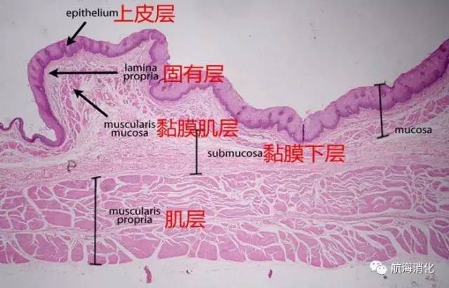 一表读懂胃黏膜活检病理报告单