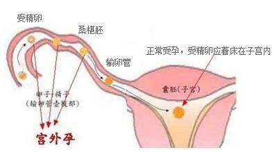 女性备孕应避免这七种不容易受孕的情况