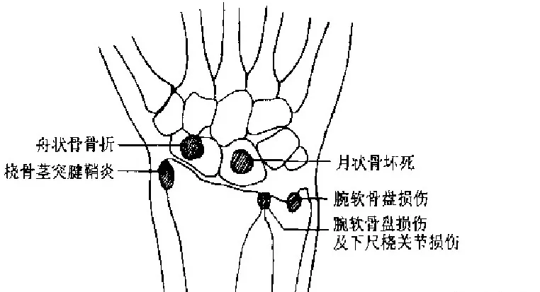 偏什么腕成语_成语故事图片(2)