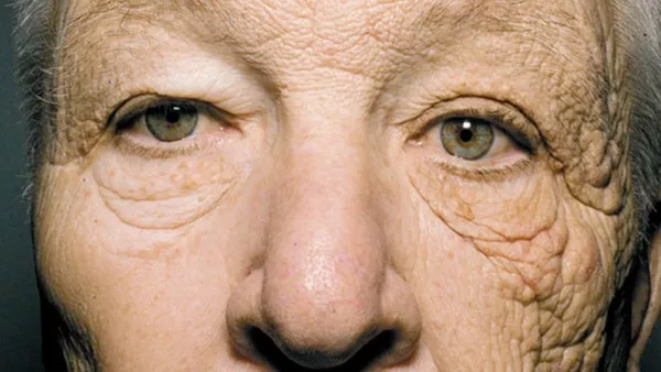 眼部皱纹怎么样护理效果最明显?