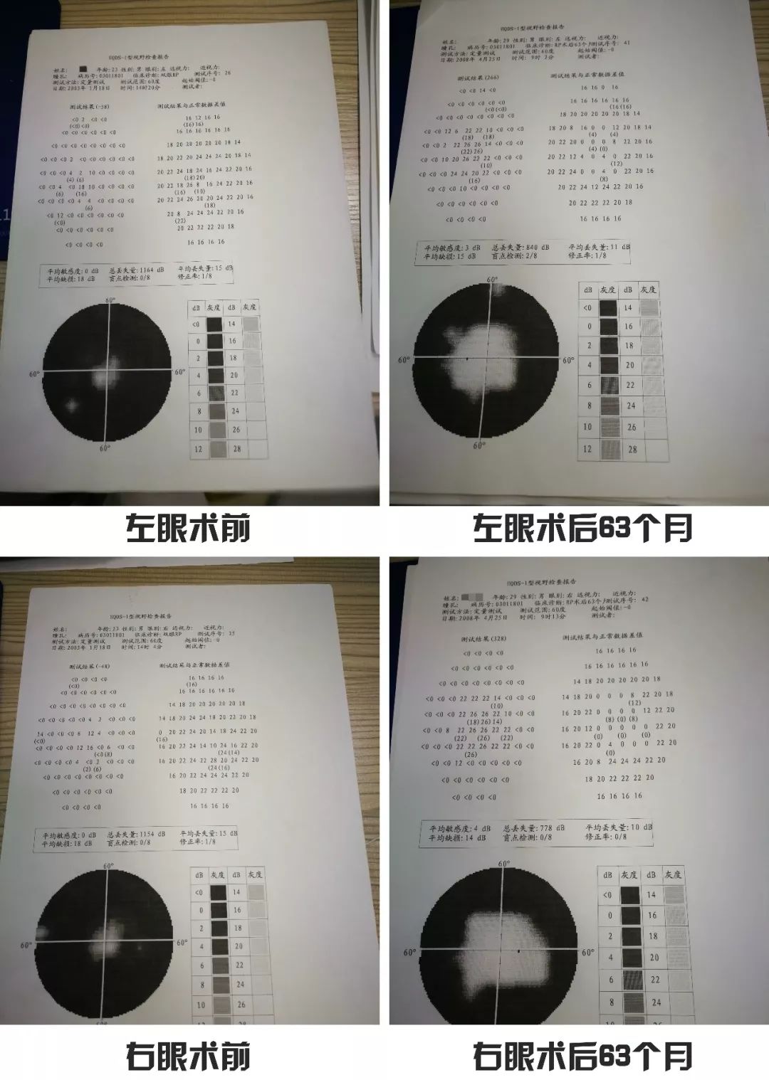 【眼科】夜盲还会导致失明?这篇文章告诉你真相!