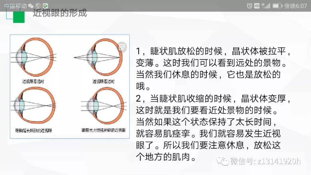 就是看远处的时候睫状肌就会收缩,晶状体会便变厚 近视眼的形成 视眼