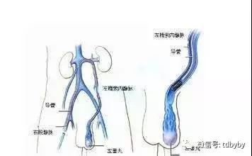 母婴 正文  1,看看直立时阴囊是否等高,阴囊壁上是否能看到蚯蚓状的