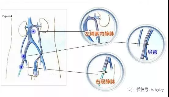 南京治疗精索静脉曲张的大概有哪些费用-爱问医院库