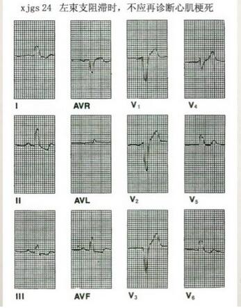心电图异常怎么办