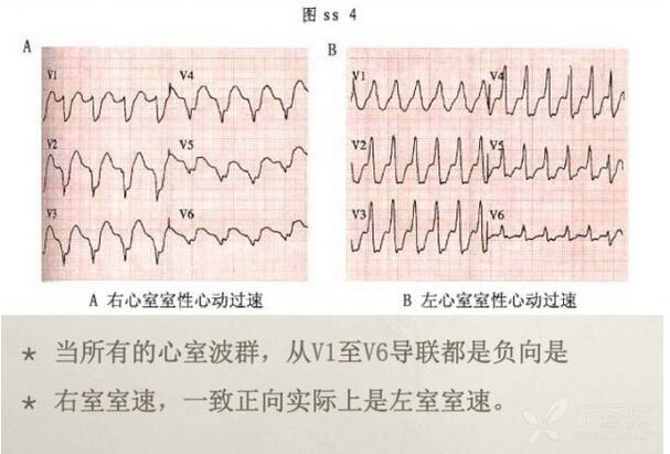 心电图异常怎么办