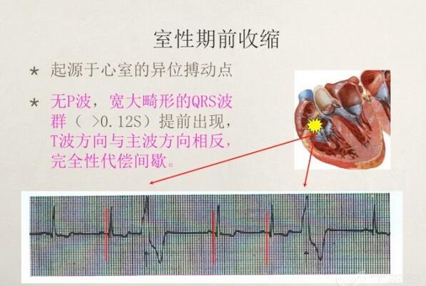 心电图异常怎么办