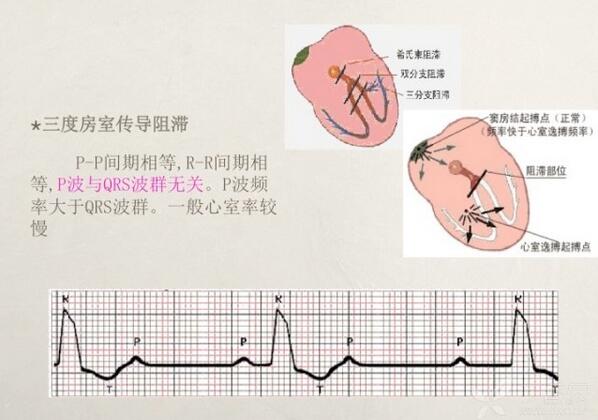 心电图异常怎么办