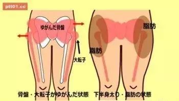 盆突怎么办