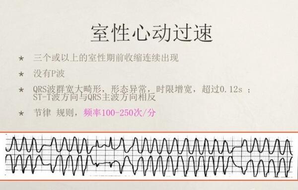 心电图异常怎么办