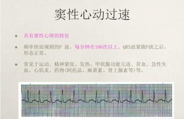 心电图异常怎么办