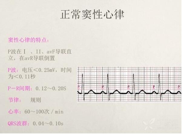 心电图异常怎么办