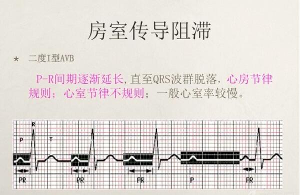 心电图异常怎么办