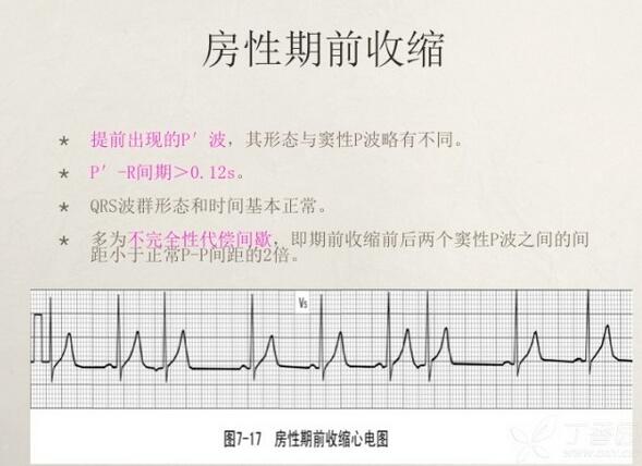 心电图异常怎么办