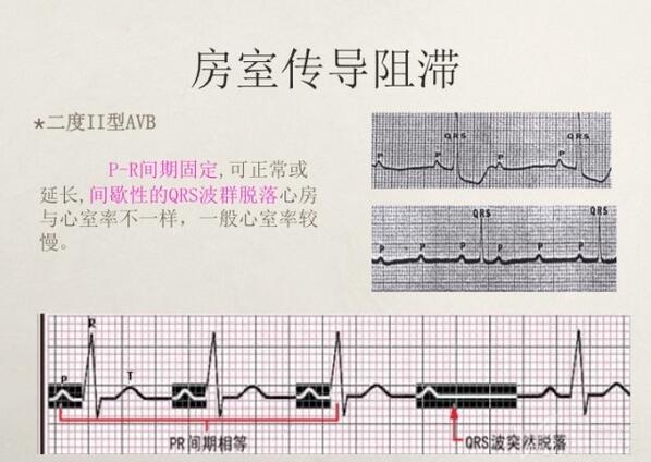 心电图异常怎么办