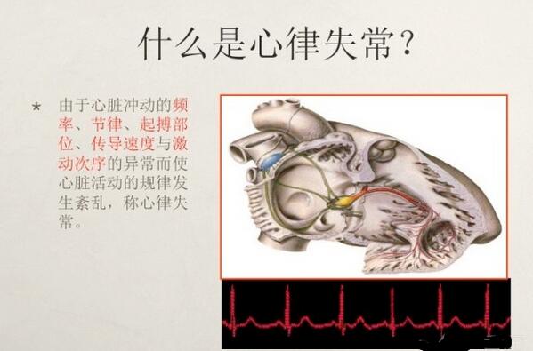 心电图异常怎么办