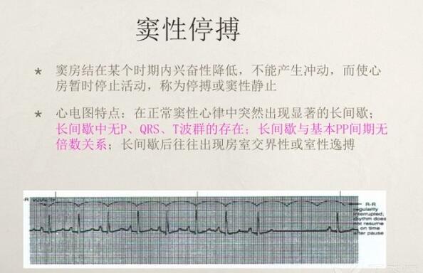 心电图异常怎么办