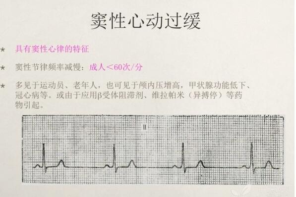 心电图异常怎么办