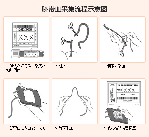 "生命银行"解答:自存脐带血的流程与费用