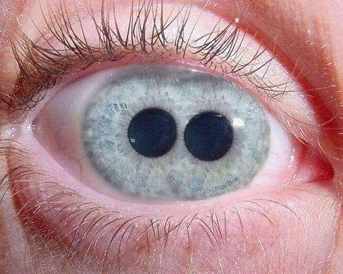 重瞳图片现实中双瞳人的照片阚清子双瞳孔图片