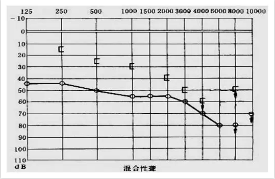 教你看懂听力图