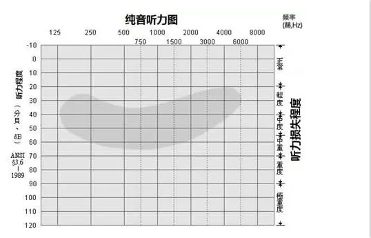 首页 其他小说 > 正文   听力健康现在越来越受到重视,那了解听力必然