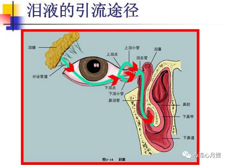 眼屎多,可能是患上了泪道阻塞,它容易滋生细菌发展成为泪囊炎,对于3个