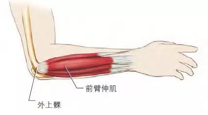 识别方法:患网球肘的运动员经常诉说肘关节外侧表面有针刺或刀刺一样