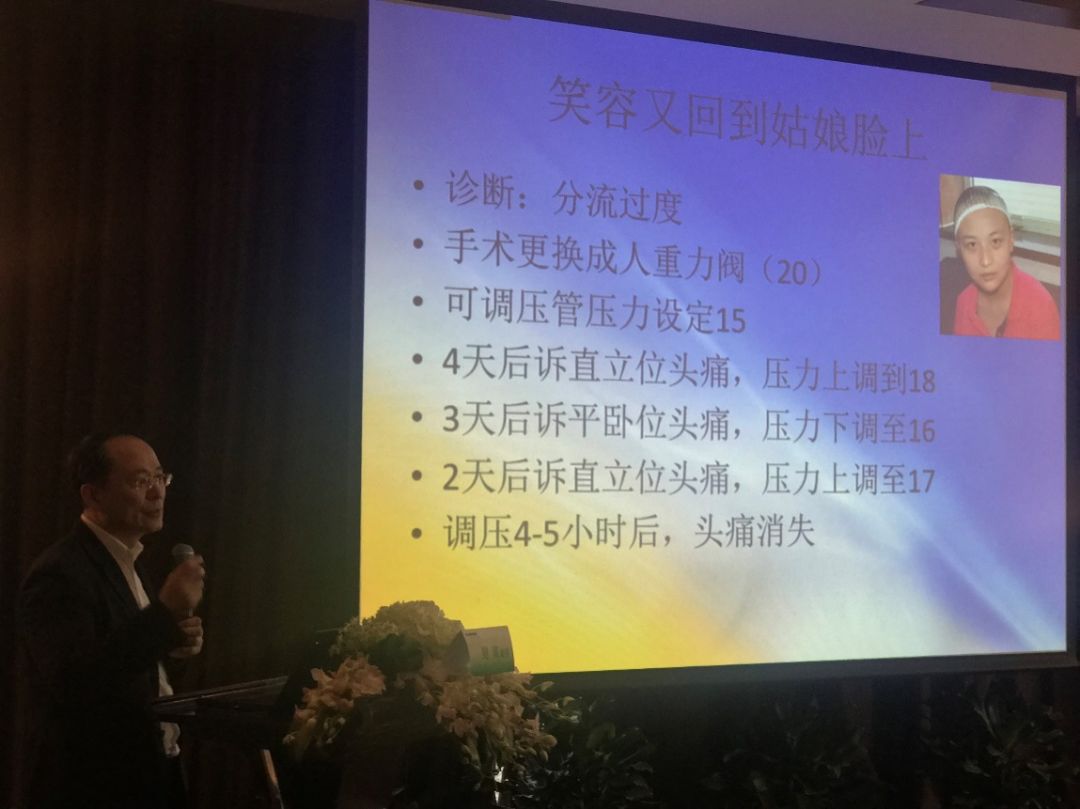 上海儿童医学中心鲍南教授讲授婴幼儿脑积水