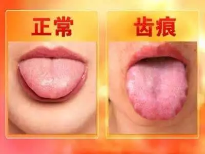 舌头是人体的自查表,出现这7种征兆就要看医生了!