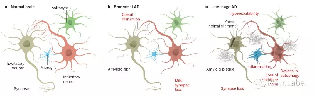 经典nature综述翻译针对阿尔茨海默病的神经环路恢复疗法路线2016年