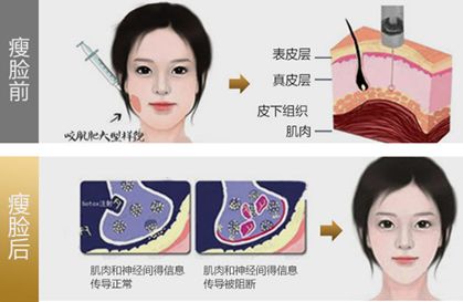 它的作用原理