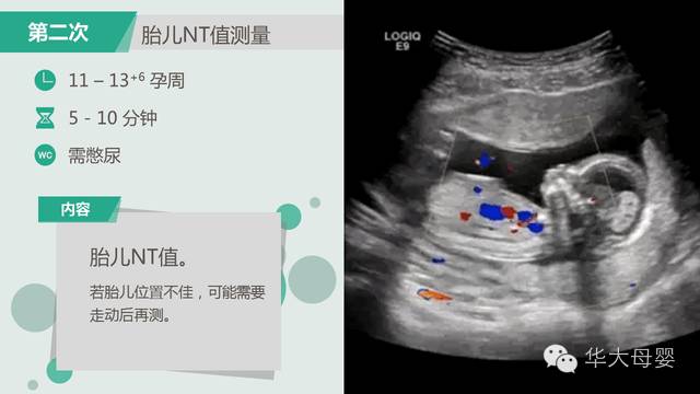 孕期超声的几十个问题,b超医生这样回答【很全】