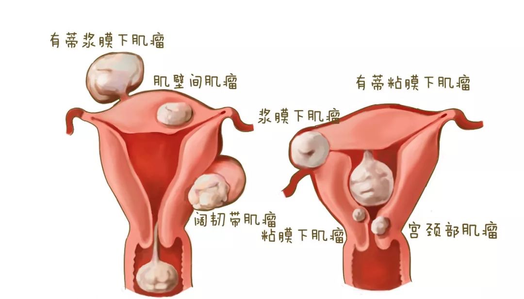 人口增长 指望 子宫(2)